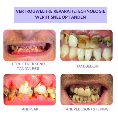 (🔥Last Day Promotion - 50% Off)  | Tanden Restauratie Mineraal Poeder