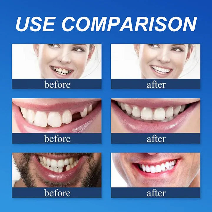 KLENIMORE Denture Comparison