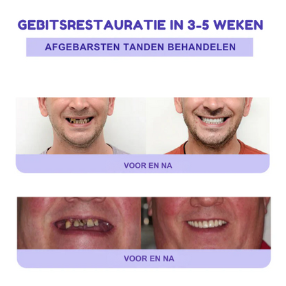 (🔥Last Day Promotion - 50% Off)  | Tanden Restauratie Mineraal Poeder