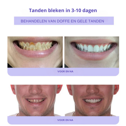 (🔥Last Day Promotion - 50% Off)  | Tanden Restauratie Mineraal Poeder