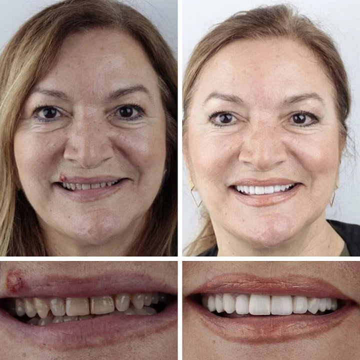 Denture Smile Customer